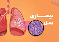 درمان و داروی بیماران مبتلا به سل در همدان رایگان است
