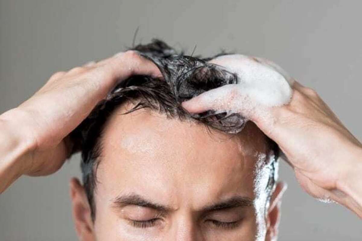 چرا موهای من همیشه چرب است؟