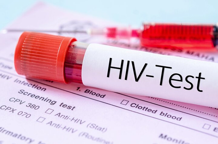 مهمترین چالش امروز HIV در ایران مهمترین چالش امروز HIV در ایران